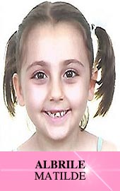 Matilde ALBRILE